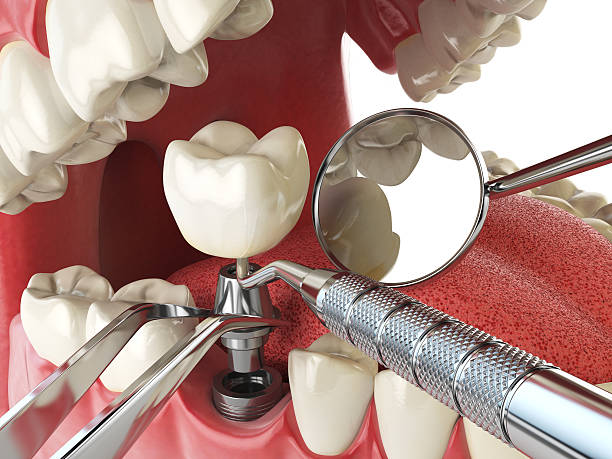 Best Emergency Dental Care for Trauma or Injury in Lindale, GA